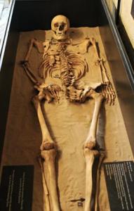Towton Skelly