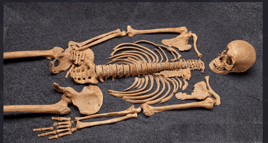 plague visctim.png